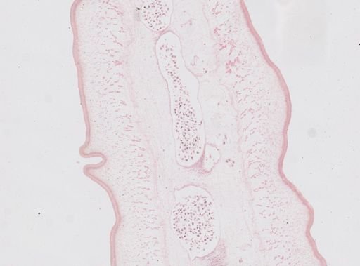 Taenia saginata