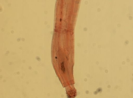 Oligacanthorhynchus microcephalus