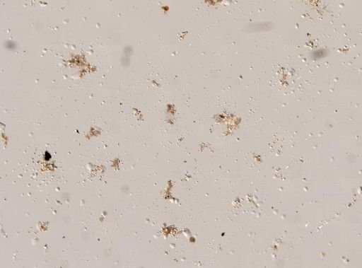Epitomapta roseola