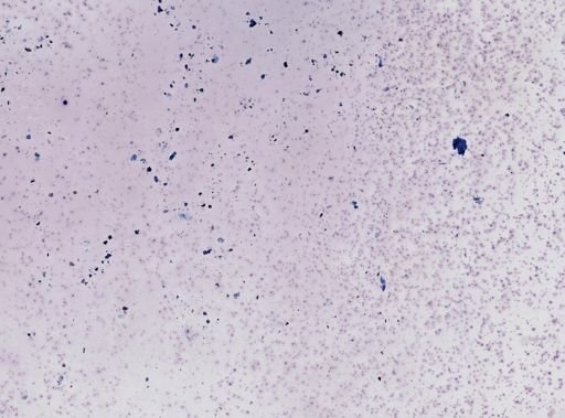 Leishmania tropica