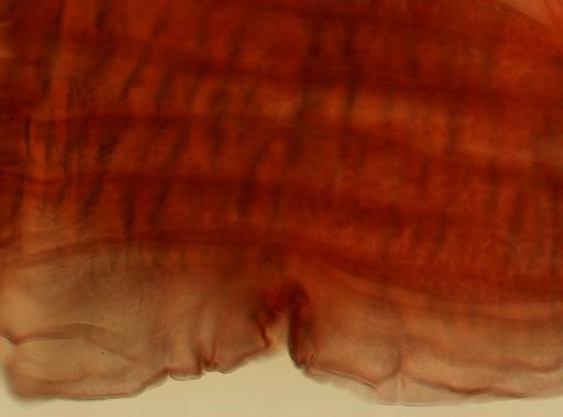 Taenia saginata