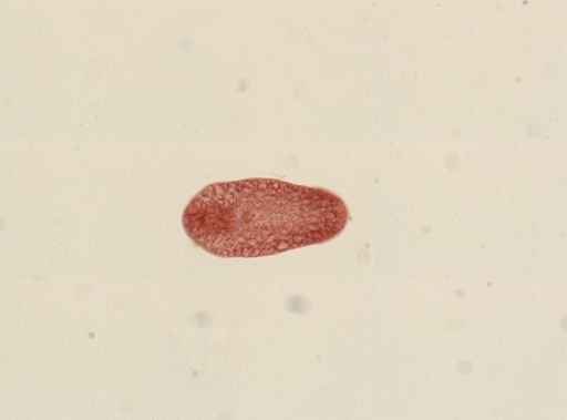Tetracotyle