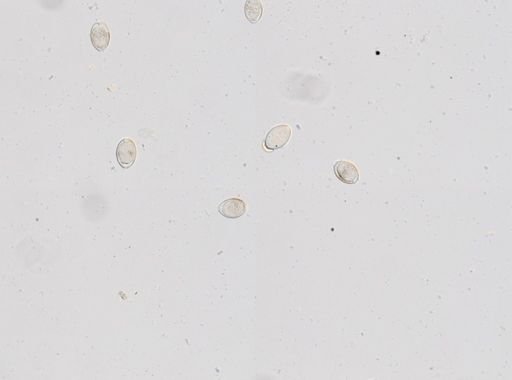 Trichuris vulpis