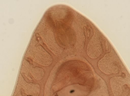 Fasciola hepatica