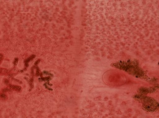 Diphyllobothrium latum