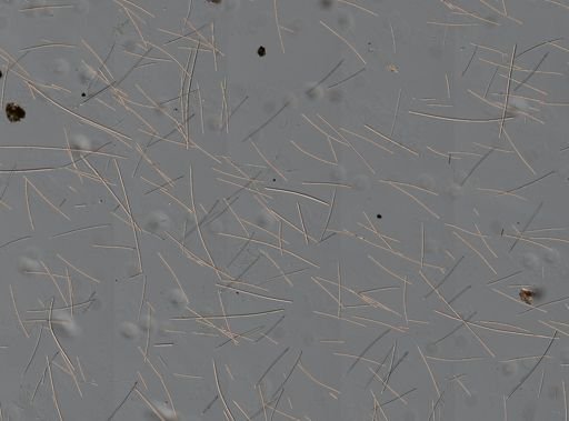 Myrmekioderma