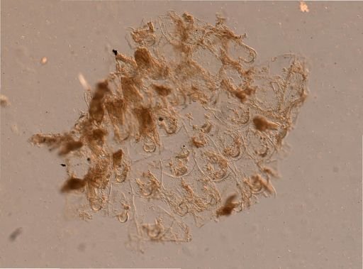 Bryozoa