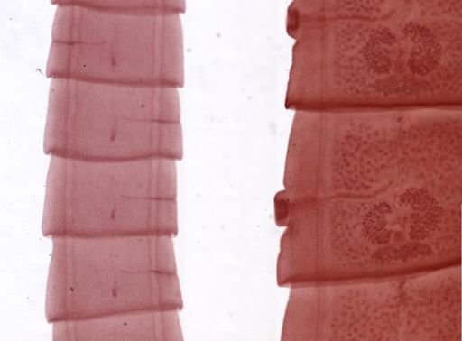Taenia pisiformis