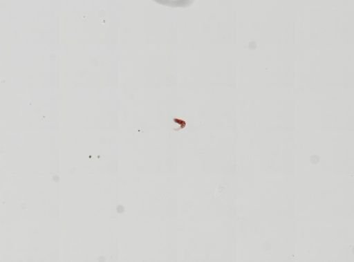 Trematoda