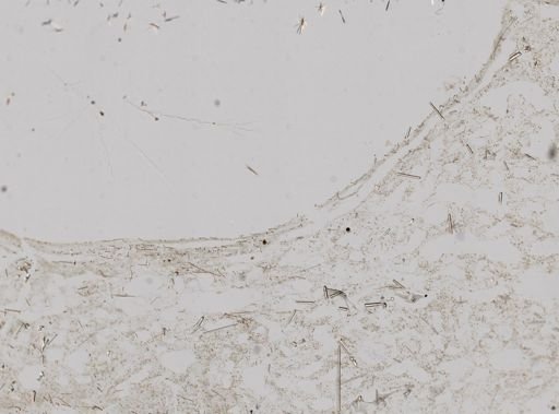 Higginsia mixta
