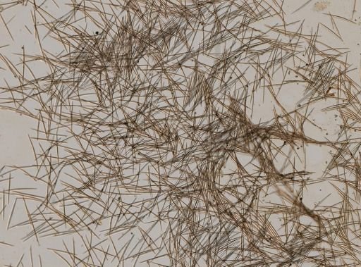 Spongilla fragilis