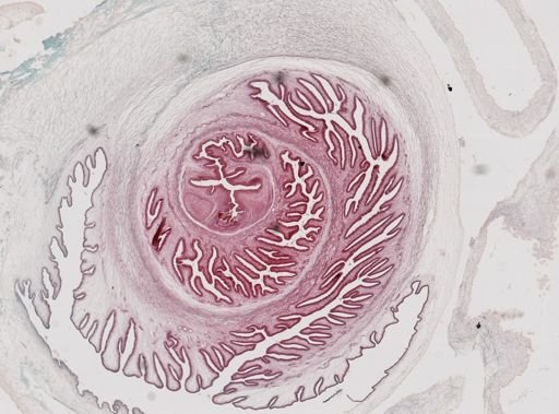 Taenia solium