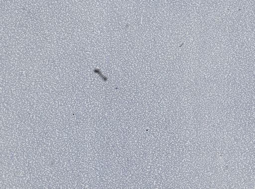 Plasmodium vivax