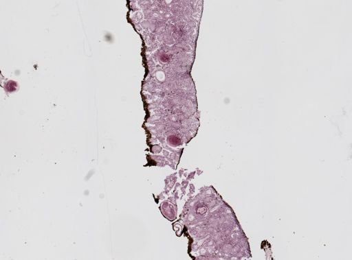 Echinostoma revolutum
