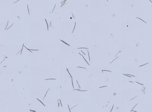 Spongillidae