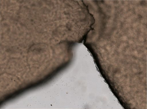 Testudinella
