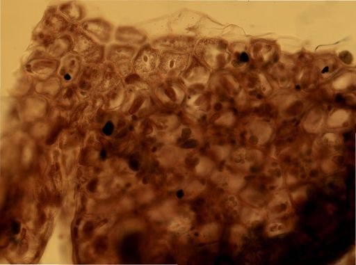 Alcyonidium
