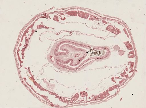 Lumbricidae