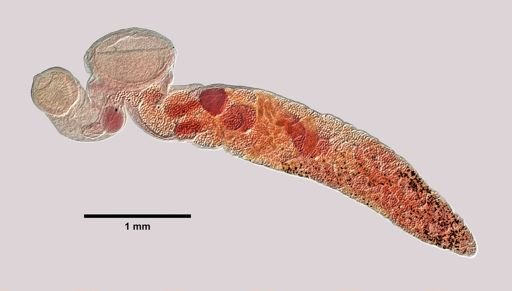 Gorgoderina attenuata