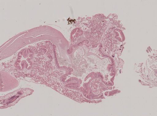 Modiolus