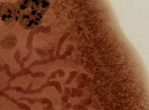 Fasciola hepatica