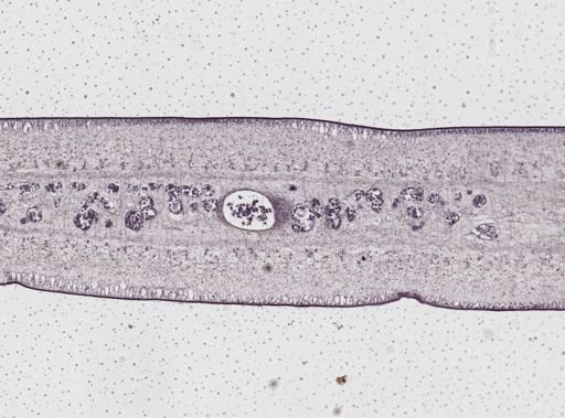 Taenia saginata