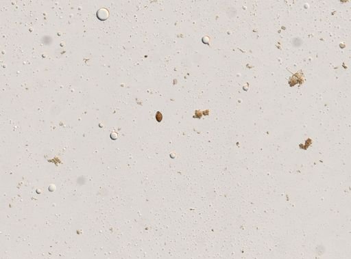 Diphyllobothrium canis