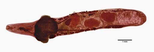 Ostiolum medioplexus