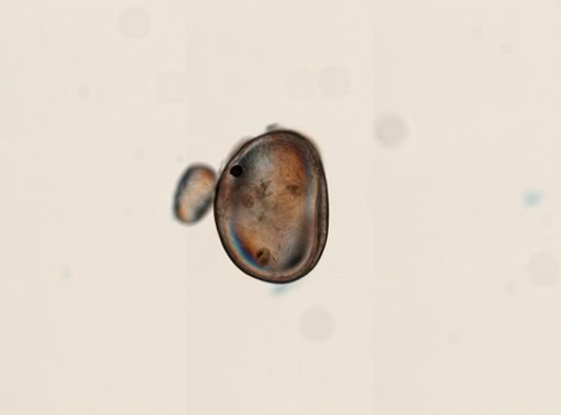 Ostracoda