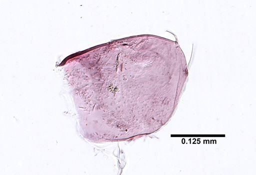 Hyalella cf. azteca