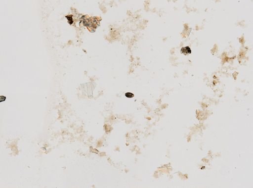 Trichuris trichiura