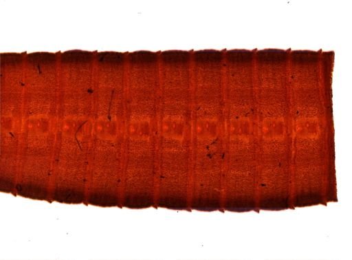Diphyllobothrium erinacei