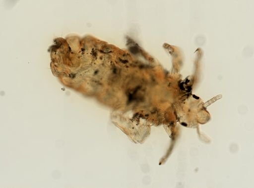 Pediculus humanus