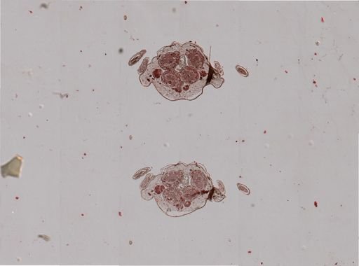 Rhopalosiphum nymphaeae