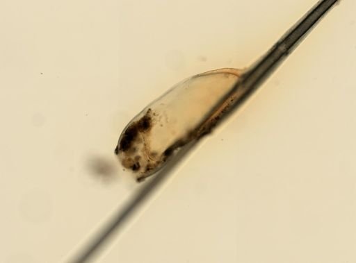 Pediculus humanus