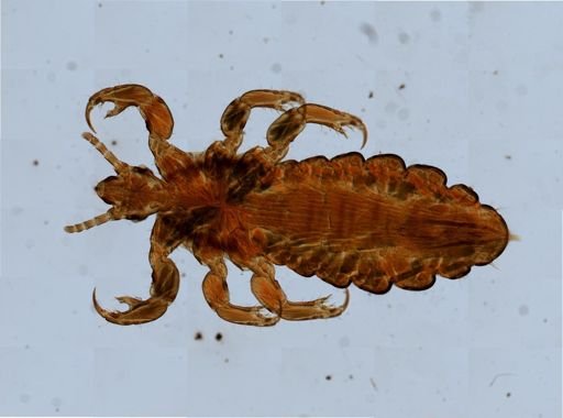 Pediculus humanus