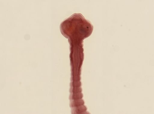 Dipylidium caninum