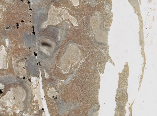 Taenia taeniaeformis