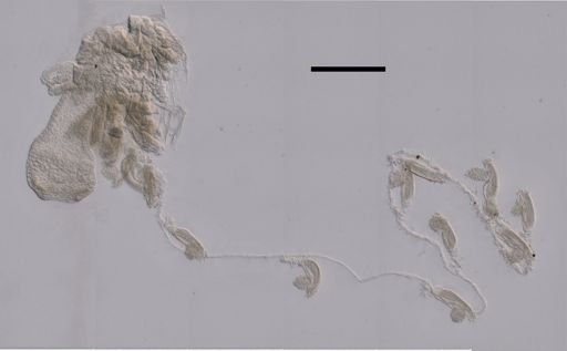 Chelophyes appendiculata