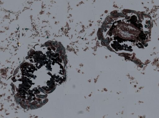 Actiniaria