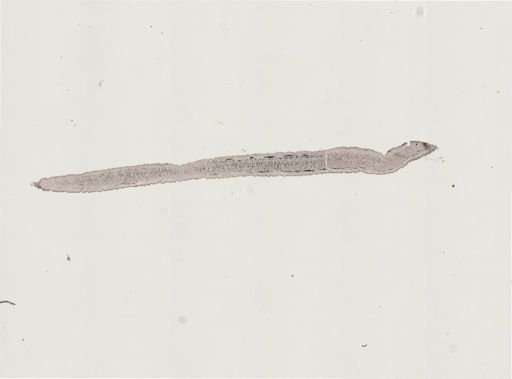 Turbellaria