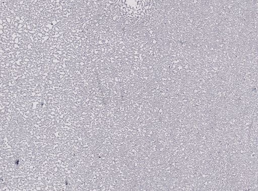 Plasmodium cathemerium