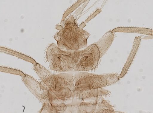 Cimex lectularius