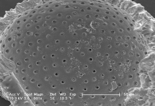 Globigerinoides ruber