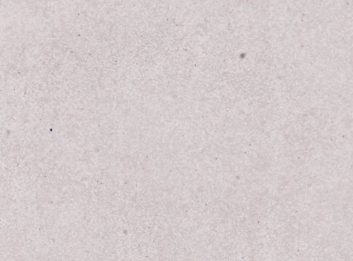 Plasmodium vivax