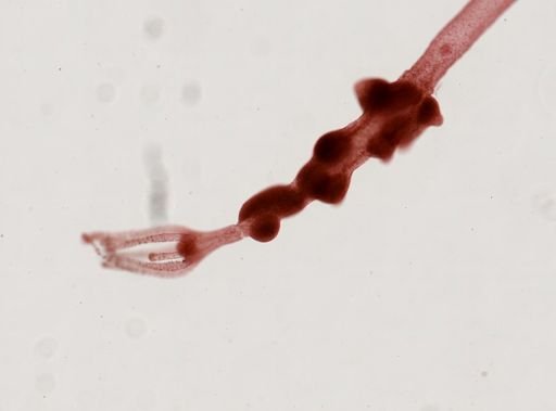 Hydra