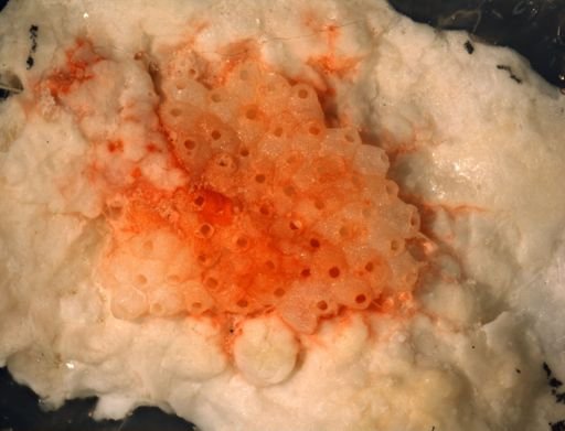 Robertsonidra nr. porifera