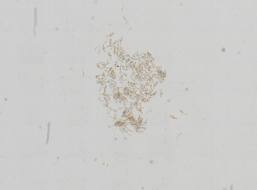 Bithynia tentaculata