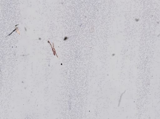 Plasmodium vivax