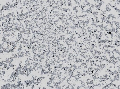 Giardia lamblia